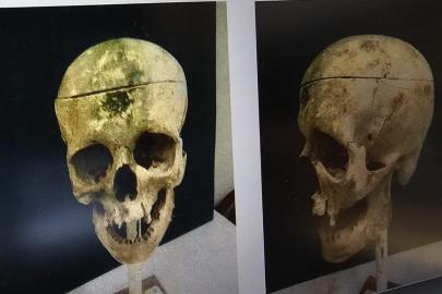 Barajdaki kemiklerle 18 yıllık cinayetin sırrı çözüldü