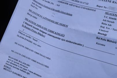 Kırşehir’de belde belediye başkanının şizofreni hastasını darbettiği iddiası