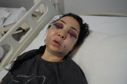 Oğlunun gözü önünde anneyi öldüresiye dövdüler: "’Küfür etmeyin’ dedik diye bu hale geldim"