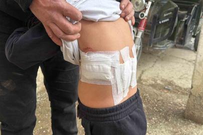 Saldırgan eşek evinin önünde oynayan 5 yaşındaki çocuğa kabusu yaşattı