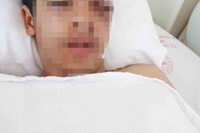 Akran zorbalığına bir yenisi eklendi: 15 yaşındaki çocuk muştayla öldüresiye dövüldü