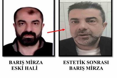 Ameliyat ile yüzünü değiştiren firari cinayet zanlısı, 7 yıl sonra yakalandı
