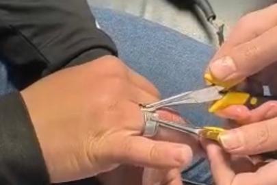 Batman’da parmağa sıkışan yüzük itfaiye ekiplerince çıkarıldı