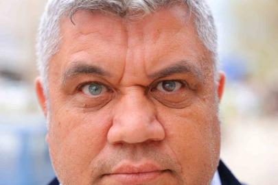 Kahramanmaraşlı adam 3 renkli gözleriyle görenlerin ilgisini çekiyor