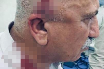 Kerkük’te kaçak yapı yıkımı sırasında kaymakama bıçaklı ve sopalı saldırı