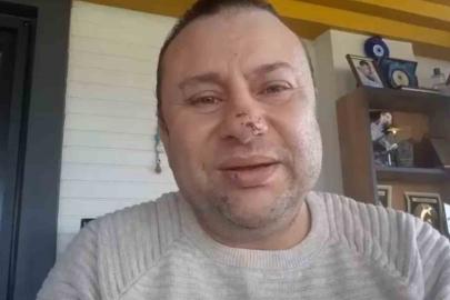 Pitbull saldırısına uğrayan Onur Akay o anları anlattı: "Ben ölümden döndüm"