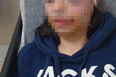 Ayrılık kararını kabullenemeyip kız arkadaşını darbeden sanık: "Çok üzgünüm"