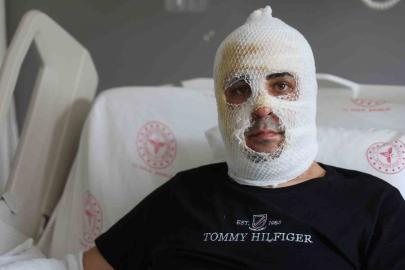 Ekmek teknesi küle dönmesin diye mücadele eden esnafın yüzü ve vücudu yaşanan patlamayla yandı