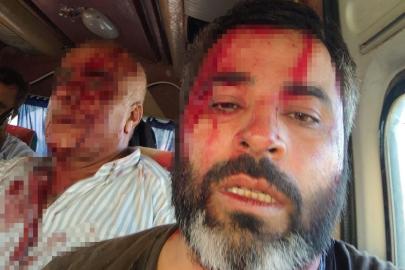 Akçakale’de meydan savaşı gibi kavga: 8 yaralı