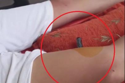 Bahçeye kaçan topu almak isteyen çocuğun bacağına korkuluk demiri saplandı