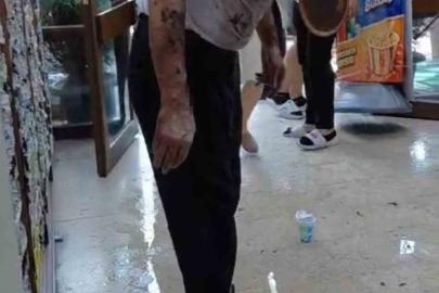 Bursa’da lavaboyu açmak için dökülen kimyasal madde patladı: 2 yaralı