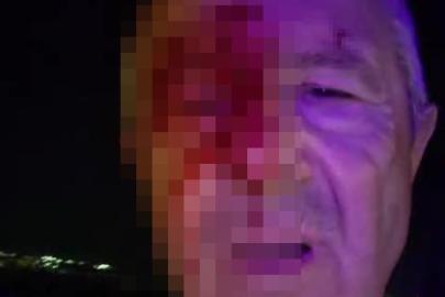 Haber yaparken saldırıya uğrayan muhabir yaralandı