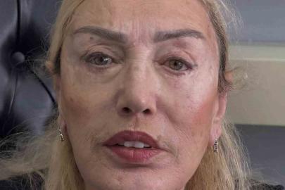 Ünlü estetikçiden Seda Sayan’ın ablasına estetik dokunuş