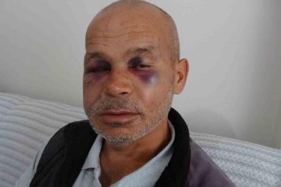 Engelli adamı darbeden şüpheli serbest bırakıldı