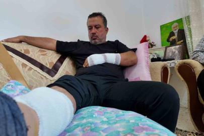 Sahipli köpeğin saldırdığı adam feci şekilde yaralandı